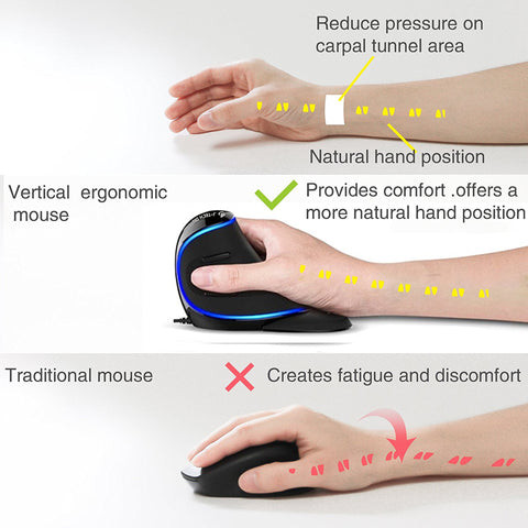 So sánh thiết kế chuột máy tính thông thường và chuột công thái học giúp giảm căng thẳng cổ tay